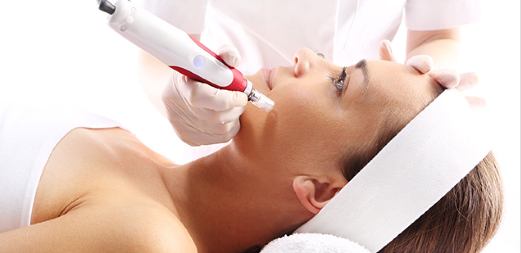 Microneedling